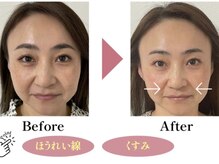 クレーヌ(CREINE)/