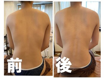 ナオフクオカ ヒーリングフォースエヌ(NaoFukuoka/healingforceN)/背中の歪み？癖や筋緊張かも。