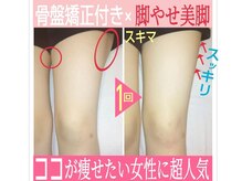 スタイル整体 やまもと整骨院の雰囲気（ココが痩せたい女性が多いので⇒実績も毎日多数！）