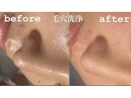 アムール(Amur)の写真