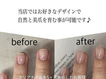 丁寧な施術と落ち着いた空間で、指先から満たされるひとときを