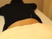 中医鍼灸治療センター/