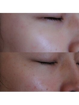 ザ シー タイムレスビューティ(THE SHE)/30代お客様症例写真