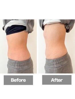 アンドリードット 堀江(&re.)/お腹張り解消!!