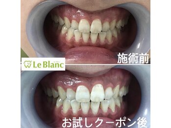 ルブラン 奈良店(Le Blanc)/気になるホワイトスポット!!