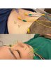 【お悩み別対応】美容鍼+鍼灸でむくみ・肩こり・腰痛・眼精疲労もスッキリ◎