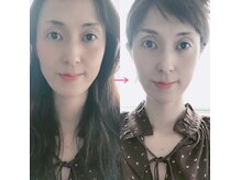 ルミナス(LUMINOUS)の雰囲気（1回で実感！嘘のようなソフトタッチな施術でスッキリ）