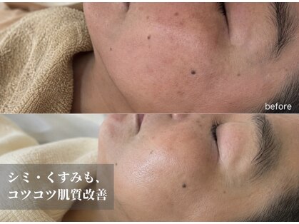 エーサロン(A-Salon)の写真