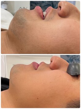 エン(enn)/【髭・美肌】