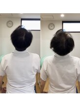 ランドル(rendre)/４０代男性　首に引っかかり感