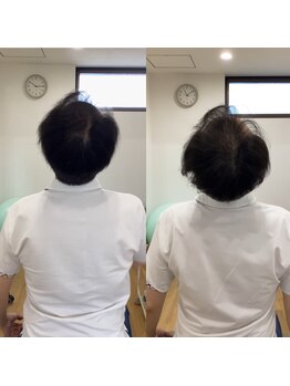 ランドル(rendre)/４０代男性　首に引っかかり感