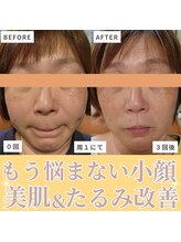 ロータスマップ(LOTUS MAP)/表面と土台のダブルのアプローチ