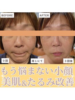 ロータスマップ(LOTUS MAP)/表面と土台のダブルのアプローチ