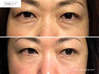 ビューティー ブロッサム(Beauty Blossom)/