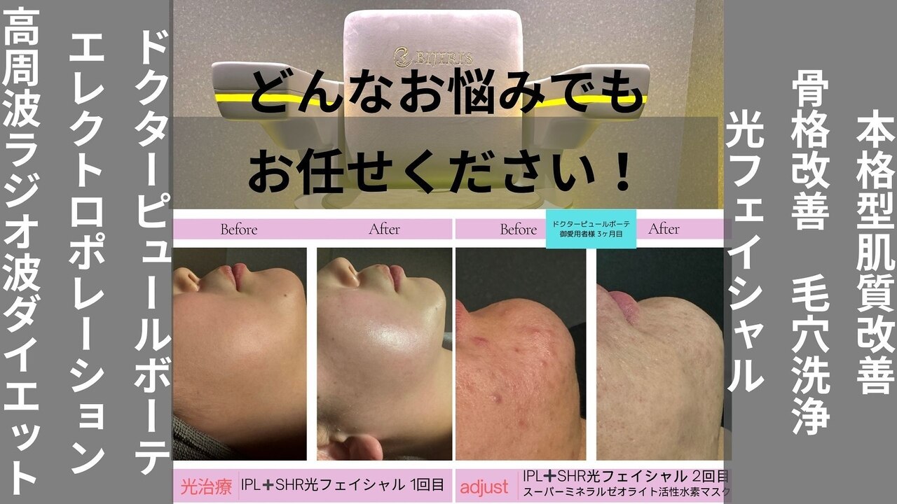 エレクトロポレーション　エステ 沖縄県でエレクトロポレーションが人気のエステサロン