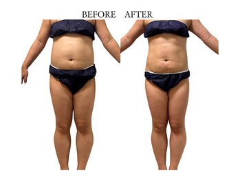 ヨサパーク サノン(YOSA PARK Sanon)/ よもぎ蒸し/痩身/リンパ