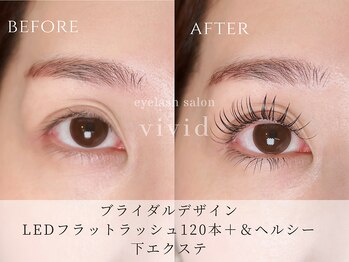 ビビッド(vivid)/パリエク進化版【&Healthy】