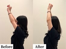 ソレア(Solea)/肩こり・巻き肩・猫背改善1回目