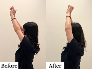 ソレア(Solea)/肩こり・巻き肩・猫背改善1回目