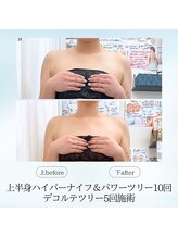 エスプレッソ(espresso,)/パワーツリーで華奢なデコルテ♪