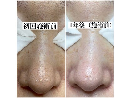 ドゥース(douce)の写真