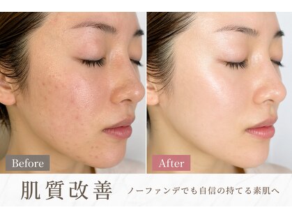 グリッター(GLITTER)の写真