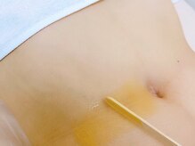 エミレ(emire)/LYCONエディケーター認定施術者