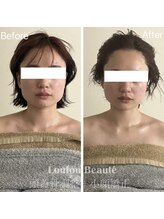 ルルボーテ(Loulou Beaute)/頭蓋骨調整＋小顔矯正