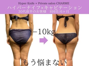 シャルム(charme)/結果出しハイパーナイフ痩身