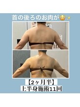 ミユサロン(Miu-salon)/首の後ろのお肉が！