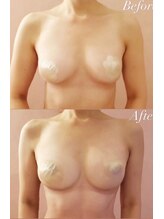 アンドボディ 横浜元町(&Body)/バストアップ・くびれ/横浜元町