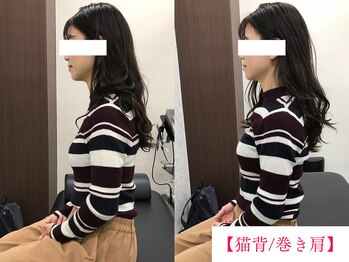 ボディメイク アールエフ サクラ接骨院(bodymake RF SAKURA接骨院)/猫背/巻き肩矯正