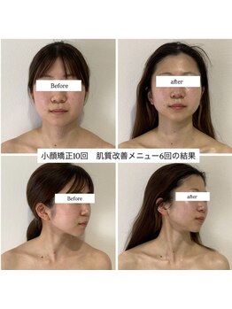 サロンメロウ 大牟田店(salon mellow)/小顔矯正×肌質改善