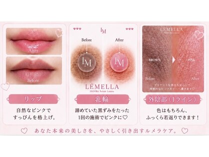 ルーナの写真