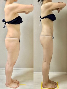 ウム 四ツ橋店(umu)/セルゼロの仕上がり