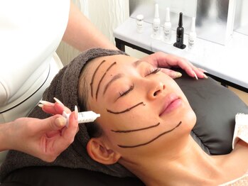 グローウィング(Growing)/ハーブピーリング