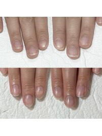 割れやすい爪も強い爪に育む