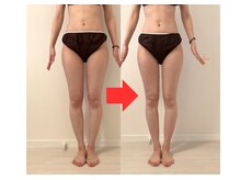 ビーチェリッシュ(B-CHERISH)/30代女性／1回