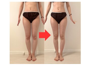 ビーチェリッシュ(B-CHERISH)/30代女性／1回