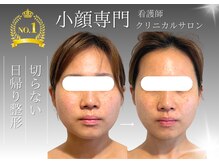 ソナ 大和西大寺院(SONA)の雰囲気（本気のたるみケア。継続が命の美容。継続しやすい価格でご提供。）