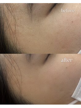 カリスコスミックビューティー 渋谷店(Charis Cosmic Beauty)/眉毛とセットで目元周りも綺麗に