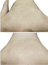 サンク アール(CinQ-R. 美九)/ブライダル