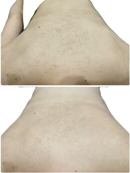 サンク アール(CinQ-R. 美九)/ブライダル