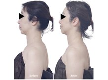 ボディケアルーム リフレキュア 中野(REFLECURE)