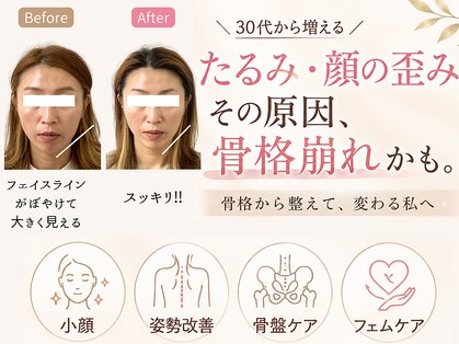 シャルモン イブ(Charmont Eve)の写真