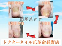ドクターネイル爪革命 長野店
