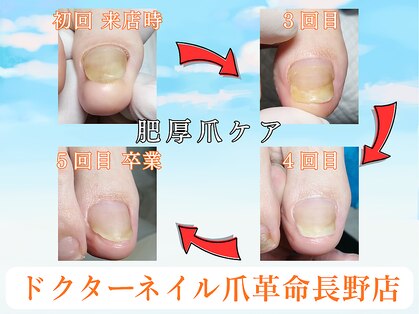 ドクターネイル爪革命 長野店の写真