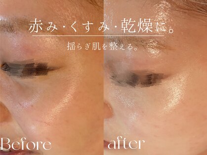 ウィハナ(wehana)の写真