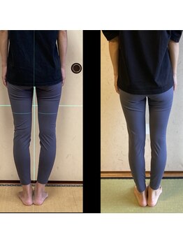 ウノ(UNO)/before/after１