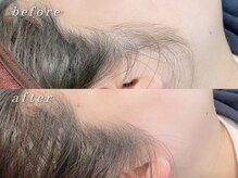 パルフェ(Parfait Eyelash Nail Salon)/【ワックス脱毛】